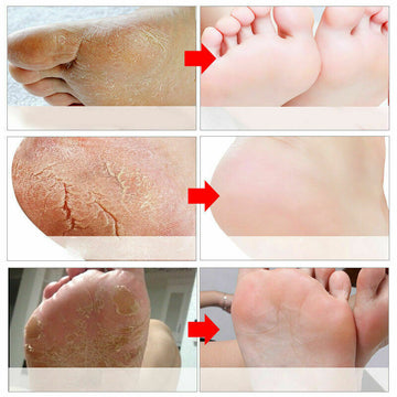 Exfoliating Foot Mask