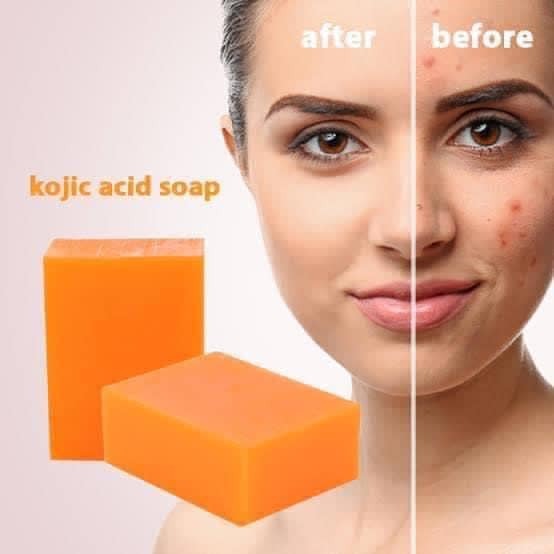 Kojie San Skin Lightening Soap